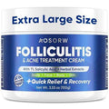 Folliculitis & Acne Treatment Cream ? Salicylic Acid & Herbal Extracts for Scalp, Face, Body & Back ? Soothes Irritated Skin, Redness & Itch Relief ? 100g (Pack of 1)