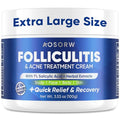 AOSORW Folliculitis & Acne Treatment Cream with Salicylic Acid & Herbal Extracts - 100g for Face, Body & Scalp
