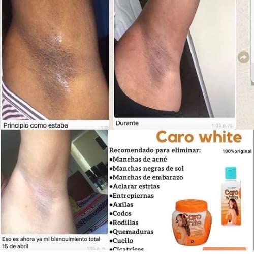 Caro White Skincare Set - Moisturizing Lotion, Cream & Soap for All Skin Types