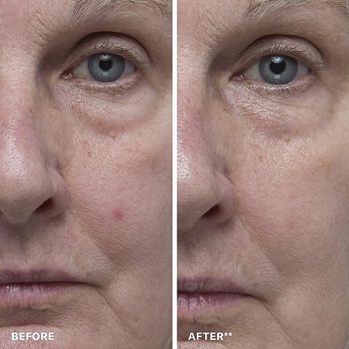Anti-Aging Exfoliating Toner with Glycolic & Azelaic Acid - Resurfacing Liquid for Smooth Skin
