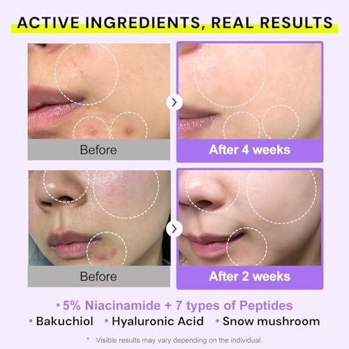 Niacinamide Peptide Serum for Skin Repair & Brightening - 50ml