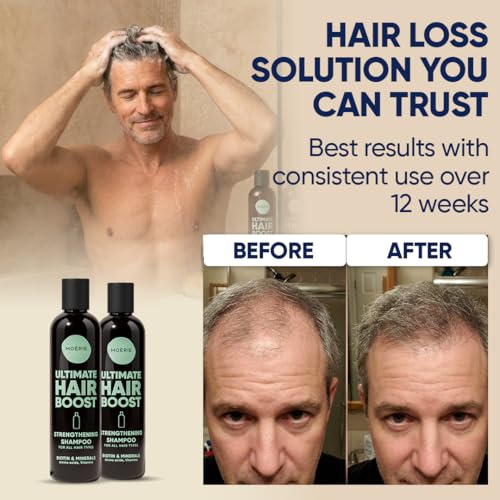 Moerie Hair Growth Shampoo Triple Set for Men & Women - Natural Thickening Solution