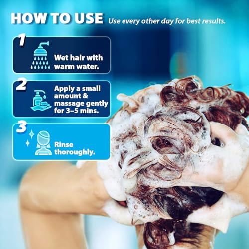 Swiftalyn Herbal Fresh Antifungal Shampoo for Seborrheic Dermatitis & Dandruff – Soothes Itchy Scalp