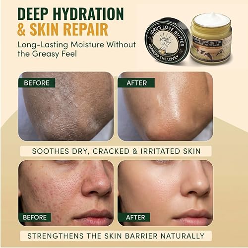 Natural Beef Tallow & Manuka Honey Face & Body Moisturizer for Dry Skin