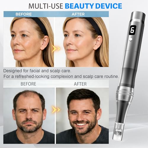 Microneedling Pen for Face - Adjustable 0.25mm Derma Roller Stylo Grey - Home Use