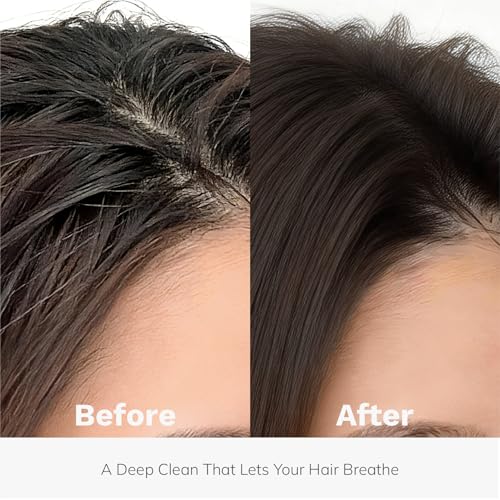 DORPANG Peptide Hair Growth Shampoo - Thinning Hair & Scalp Balance - Restore Shampoo - 355ml