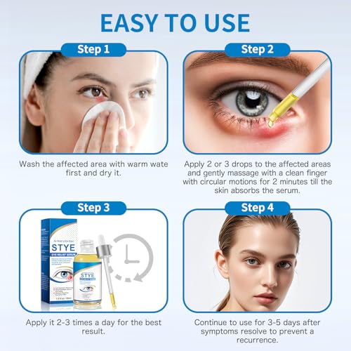 Stye Eye Treatment, Natural Stye Relief Serum for Styes, Chalazions and Blepharitis, Quickly Relieves Eye Irritation and Restores Healthier Skin,30ML