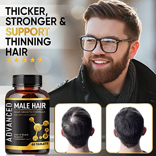 Men's Hair Growth Vitamins - Supports Thicker, Fuller Hair & Beard - DHT Blocker & Biotin Supplement