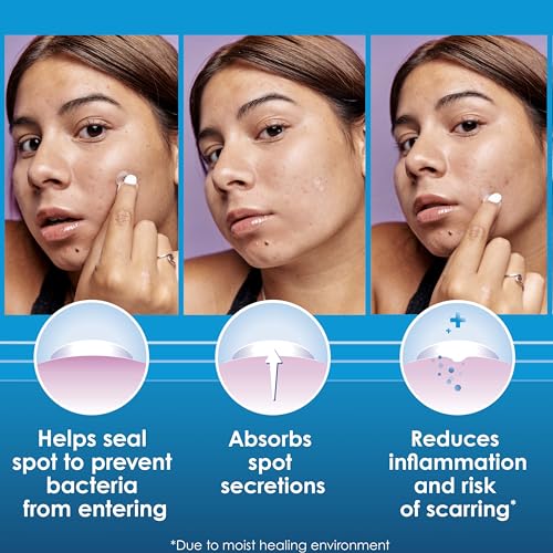 Clearasil Day and Night Spot Patches, Advanced Healing Hydrocolloid Acne Pimple Treatment, Blemish Spot Stickers for Face, 30 Count