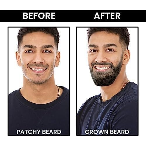 Beard Oil for Men-100ml | Natural Beard Growth Oil for Men with Argan & Rosemary for muuchstac Fast Growth Conditioner and Softener - Strengthens Beards and Mustaches for Men