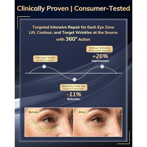 Under Eye Red Light Therapy Device, Red Light Therapy Glasses for Eyes 630¡¾10nm,Red Light Eye Mask for The Treatment of Eye Bags,Dark Circles,Puffiness periorbital for Treating