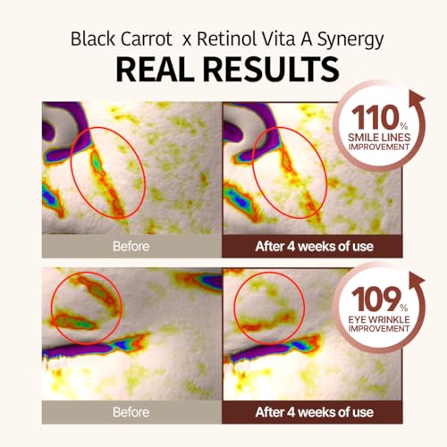 Black Carrot Retinol Moisturizer - Anti-Aging Face Cream with Niacinamide, Pore Minimizer, 48H Hydration