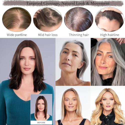 Hair Toppers for Women 14 Inch Real Human Hair Dark Brown with Reddish Undertone - 4x4.8 Inch Middle Part, Hand-Tied, Natural Scalp Line, Lightweight & Breathable - Variation: 4.0x4.8 Inches, 14 Inch, 4 Clips