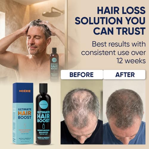 Moerie Hair Growth Shampoo for Thinning Hair (Clear) | Biotin, Rosemary & Caffeine