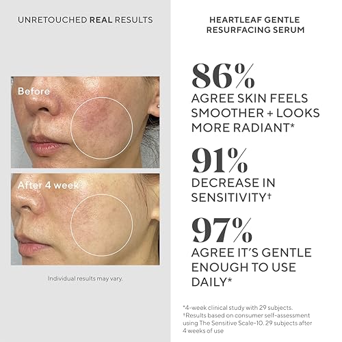 Murad Heartleaf Gentle Resurfacing Serum ? Low-Dose Glycolic Acid, AHA and Heartleaf Comfortably Exfoliates Senstive Skin to Improve Radiance and Smooth Fine Lines & Wrinkles ? 1.0 Fl Oz