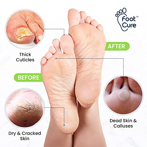 Tea Tree Oil Foot Cream - Moisturizing Athletes Foot Care For Dry Cracked Feet Cream - Heel & Callus Removal,& Tea Tree Foot Soak, Callus Remover Gel Foot File Pedicure Kit