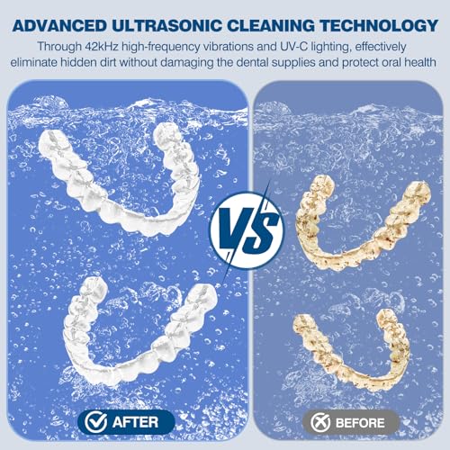 Ultrasonic Dental & Jewelry Cleaner Machine - 42KHz Deep Cleaning Pod 180ml