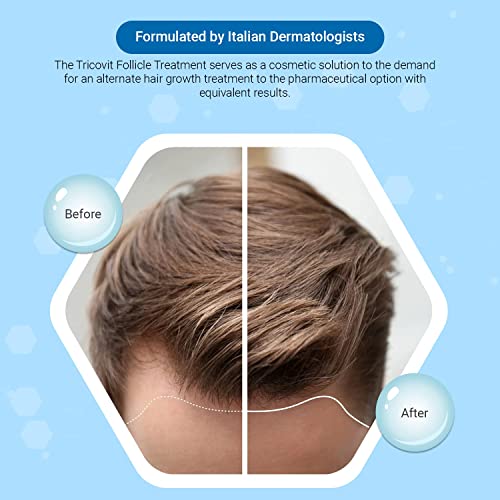 Tricovit Hair Growth Shampoo for Men & Women - Scalp Regrowth & Hair Thickening (8.4 oz)