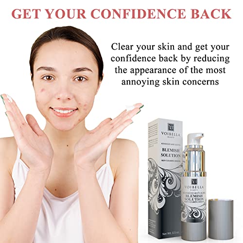 VOIBELLA Acne Spot Treatment Serum for Pimples & Redness, Gentle Skin Care