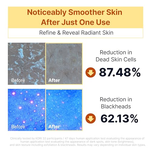 SUNGBOON EDITOR Kojic Acid Brightening Serum for Dark Spots & Even Skin Tone - 1.01 fl oz