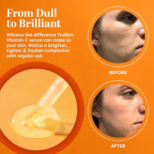 TruSkin Vitamin C Serum & Liquid Exfoliant Duo ? Vitamin C Face Serum 1oz & AHA, BHA, PHA Liquid Exfoliant 4.2oz for Brighter, Smoother Skin