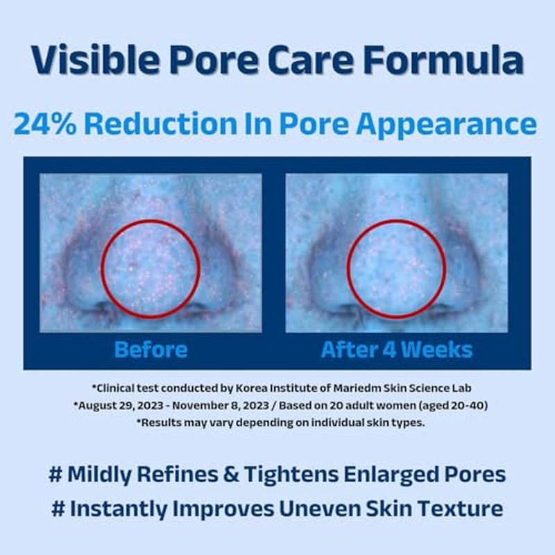 ACNIOME Pore-Care Gel Moisturizer, Lightweight Oil-Free Daily Hydration for Oily & Sensitive Skin, With Salicylic Acid & Hyaluronic Acid, Non-Sticky, Perfect Under Makeup, 1.69 fl oz