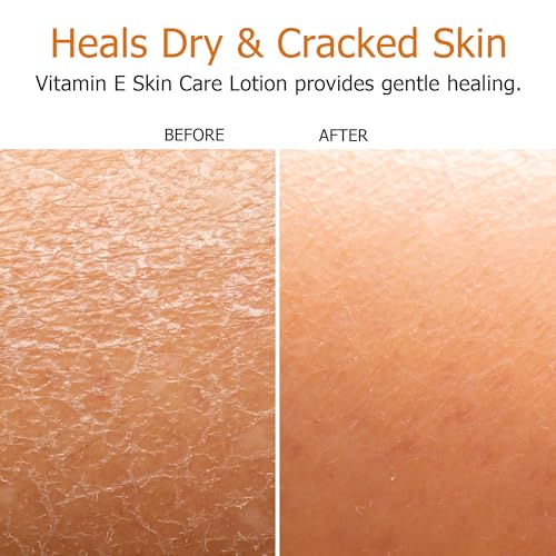 Fruit of the Earth | Vitamin E lotion 16 oz (6pack) | with Natural antioxidants