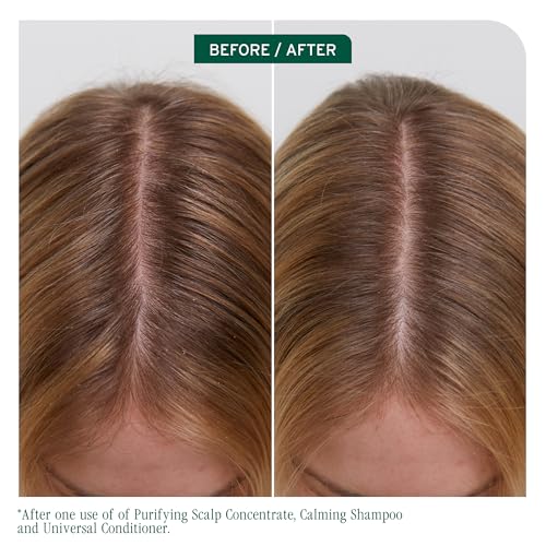 Biolage Scalp Sync Universal Conditioner 7.9 Fl Oz for All Scalp Types