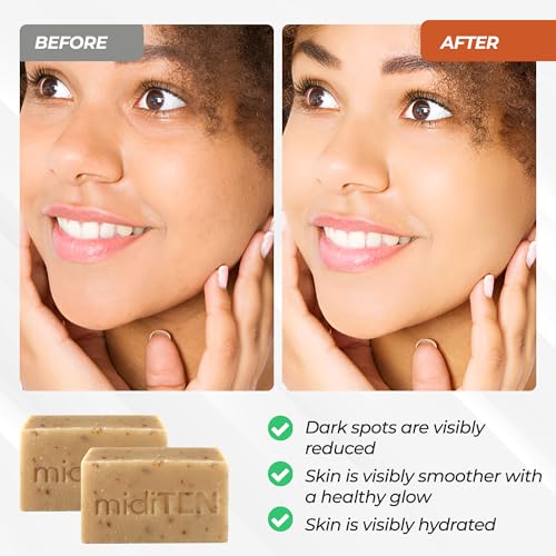 a.l.m. Magical Patch (2) Hydrocolloid pimple patches. These ultra thin & translucent hydrocolloid adhesive covers and absorb unwanted pimples. Parches Para Acne for skincare.
