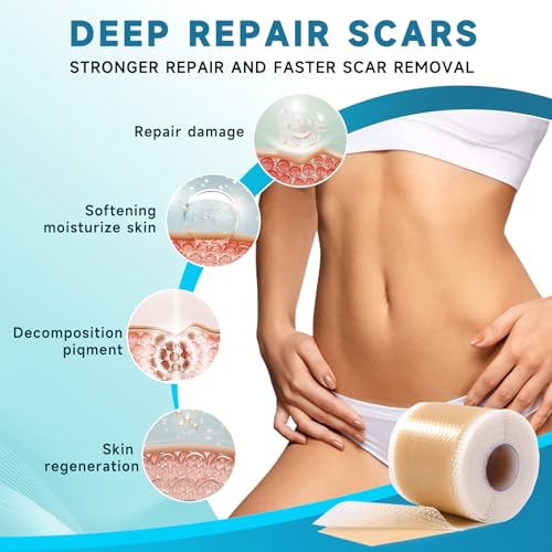 Rvlaim Medical-Grade Silicone Scar Sheets 4M Roll for Keloid & Surgical Scars