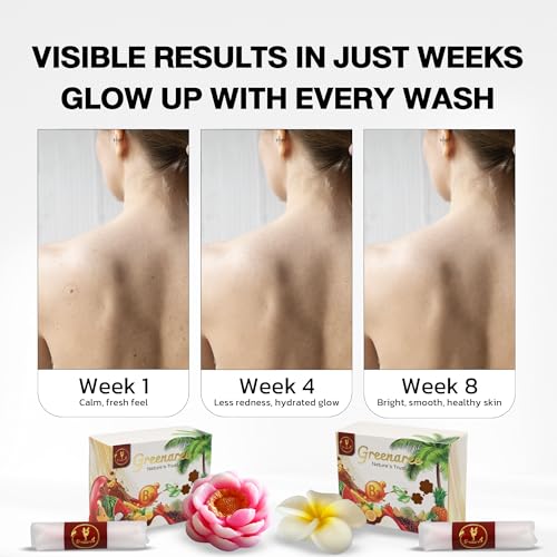 Fruit & Flower-Shaped Natural Soap Bar with Vitamin B3 & Aloe Vera ? Moisturizing, Gentle for Sensitive Skin, Includes Foam Net, Handmade in Thailand ? Body & Hand Use (1 Bar)