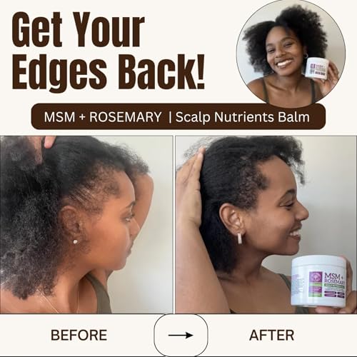 Qhemet MSM & Rosemary Hair Growth Balm for Dry Scalp & Thinning - Vegan, 4 oz
