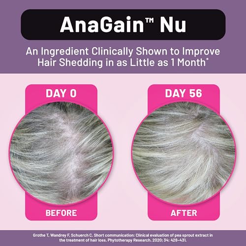 Hair Growth Supplements for Men & Women - Vegan, Sugar-Free, 15 Oz