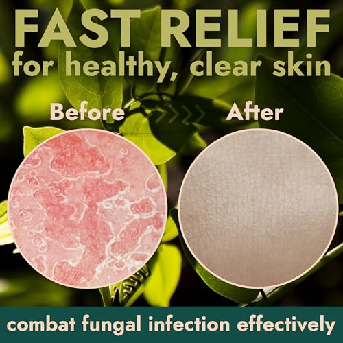 Antifungal Tea Tree Soap 2 Pack with Scrubber for Jock Itch & Ringworm