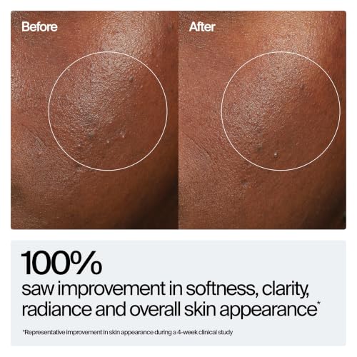 Neutrogena Hydro Boost Hyaluronic Acid Rejuvenating Serum 1 Fl Oz