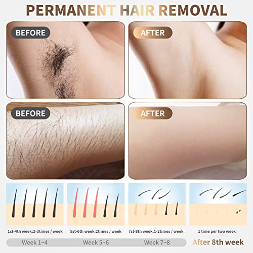 Gransumr White-Purple IPL Hair Removal Device for Body & Face, Painless & Fast, 86% Hair Reduction, 5 Modes, 8-Min Full Body Use