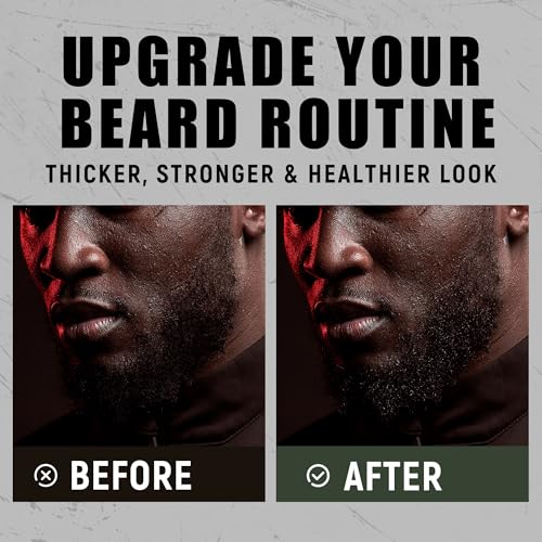 Beard Grooming Kit for Black Men, Beard Care Kit for Black Men w/Oil, Balm, Brush, Comb and Scissors, Valentines Birthday Gifts for Dad Husband Boyfriend