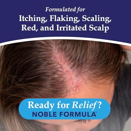Noble Formula 2% Pyrithione Zinc Dandruff Shampoo, 8 oz – Scalp & Body Cleansing