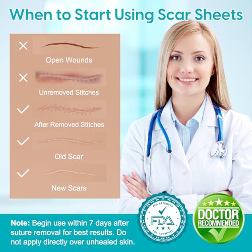 Silicone Scar Sheets (1.6¡± x 120¡±), Medical Grade Scar Tape for C-Section, Surgery, Keloid, Burn, Acne Scars - Reusable, Pain-Free, Safe for Sensitive Skin
