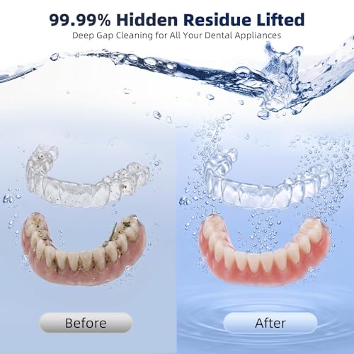 Ultrasonic Retainer Cleaner Machine 45kHz 200ML Dual Modes - White