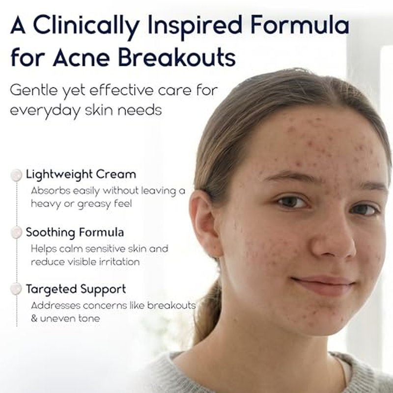 Azelaic Acid 15 Acne Cream for Face - Redness Relief, Rosacea Treatment for Face - Soothes Acne, Hyperpigmentation, Enhanced Formula for Brighter, Healthier Skin Care