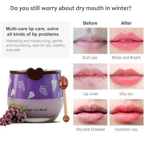Charm Kiss Bee Lip Balm Lip Mask Set A - 12 Fruit Flavors Honey & Vitamin E