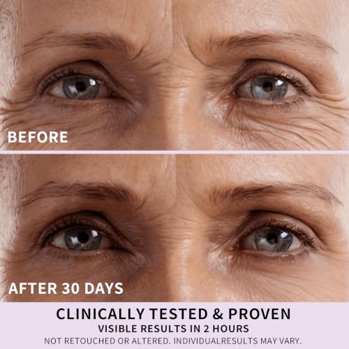HerbBliss Collagen Retinol Hydrogel Eye Patches - Hydrating 12 Pairs - Variation of 12