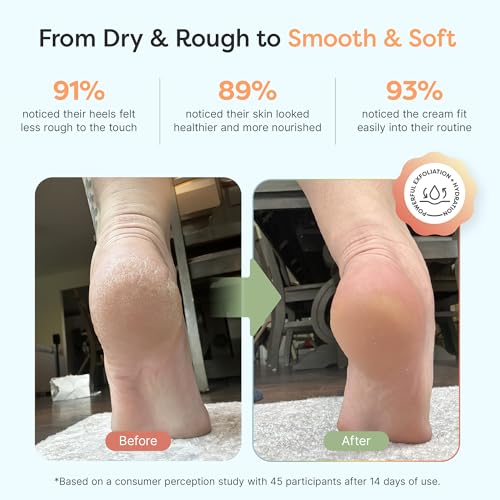 Urea Foot Cream 40% with Shea & Hyaluronic Acid - 5 oz Pack of 2 for Cracked Heels