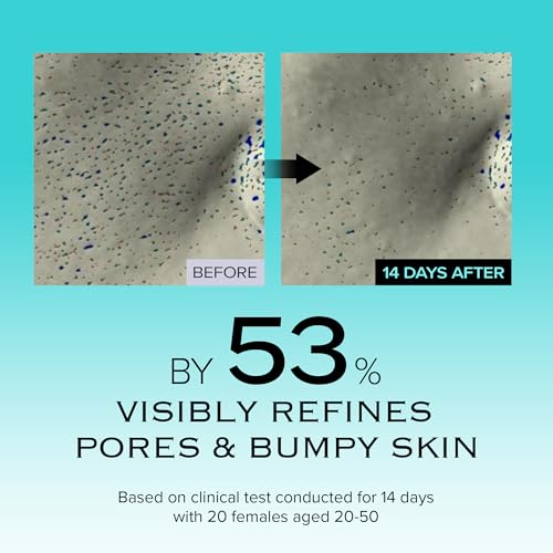 Ice Sorbet Soothing & Cooling Face Moisturizer | Non-Comedogenic Gel Cream for Fungal Acne | Pore Minimizer for Face Under | Makeup Primer | Niacinamide & Silica for Sebum Control | 3.38 Fl Oz