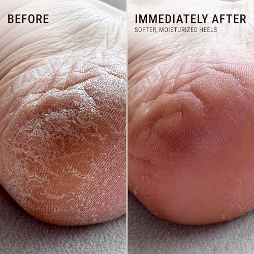 Heel Repair Balm & Moisturizing Socks Duo for Cracked Heels - Foot Care Set
