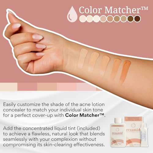 Acne Spot Treatment Lotion with Sulfur & Resorcinol, Skin Tone Matching Concealer, 2oz