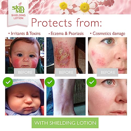Skin MD Shielding Body Lotion for Sensitive Skin - Hydrating, Non-Greasy, Fast Absorbing 8oz