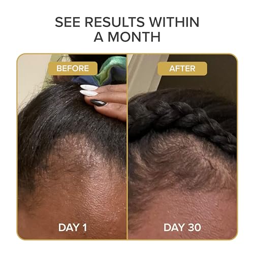 Shedavi Vegan Hair Serum with Botanicals 2 Fl Oz - Growth & Damaged Hair Treatment