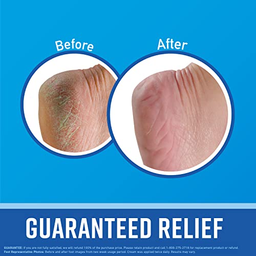 O'Keeffe's Healthy Feet Foot Cream 3.2oz Pack of 3 - Heals Cracked Dry Feet